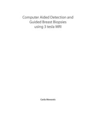 Computer aided detection and guided breast biopsies using 3 Tesla MRI